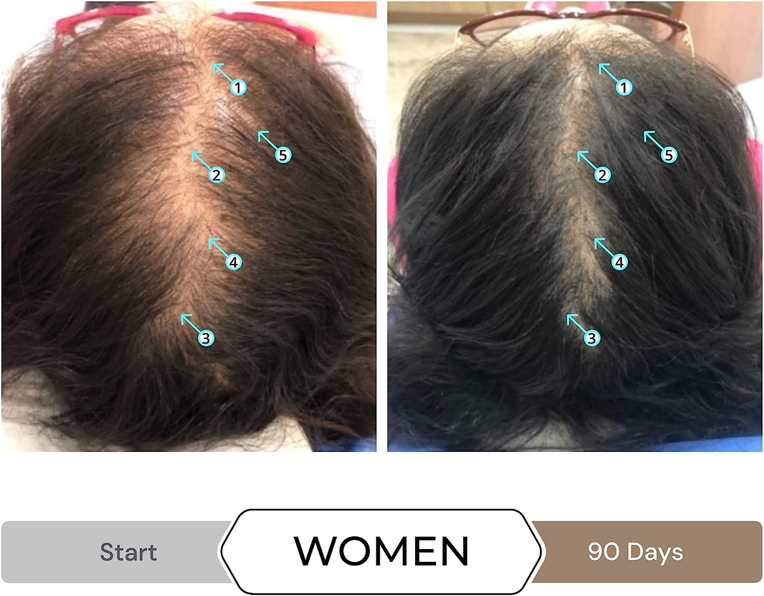 سرم تقویت کننده مو مردانه مدل Spectral.DNC-N Hair DS0313 - ارسال الی 10 الی 15 روز کاری