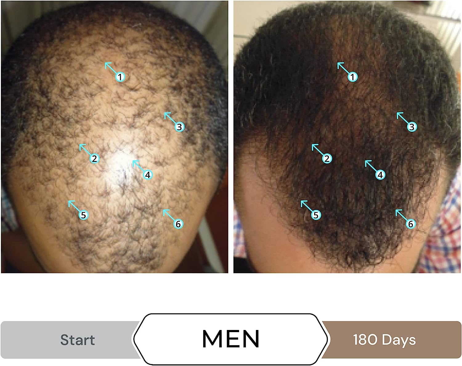 سرم تقویت کننده مو مردانه مدل Spectral.DNC-N Hair DS0313 - ارسال الی 10 الی 15 روز کاری