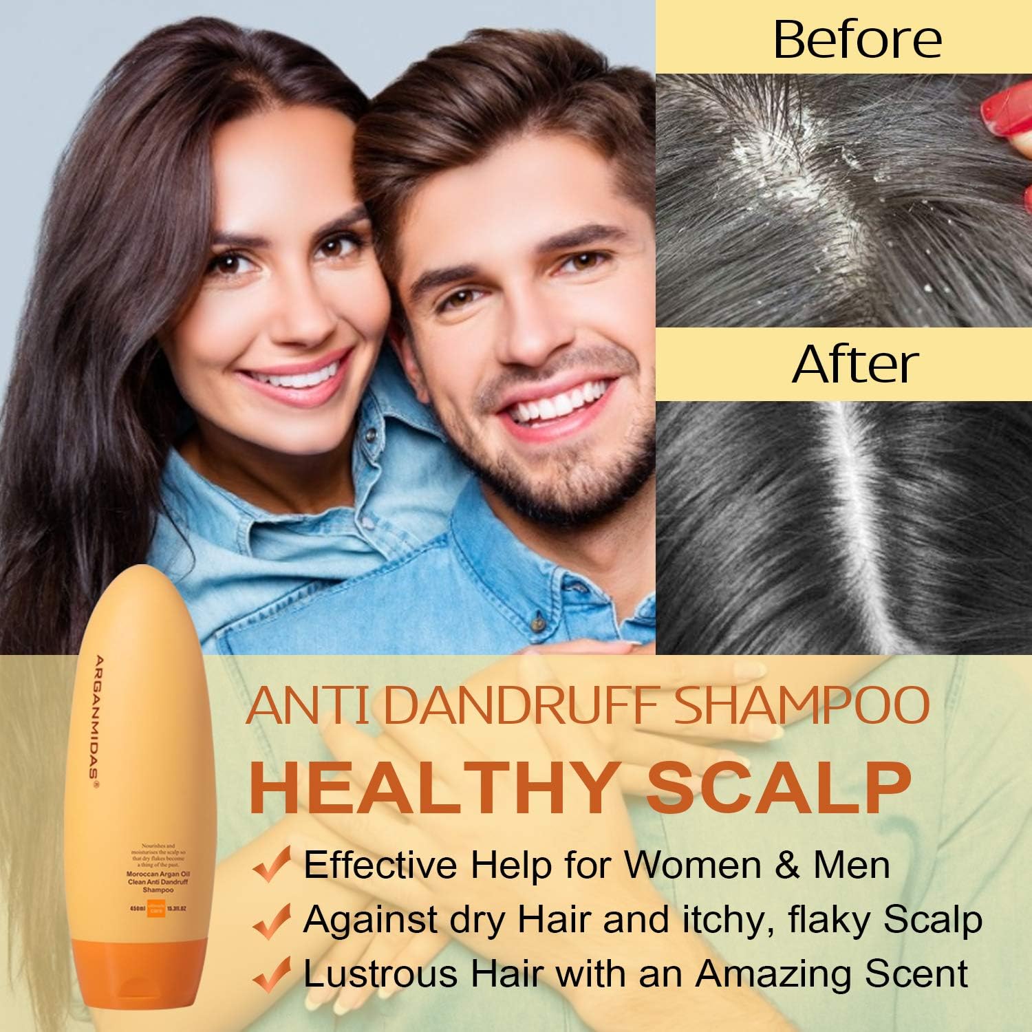 شامپو درمان ضد شوره سر آرگان میداس مدل Anti Dandruff Treatment Shampoo - ارسال 15 الی 20 روز کاری